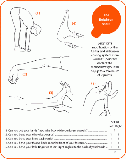 joint-hypermobility-awfig-1